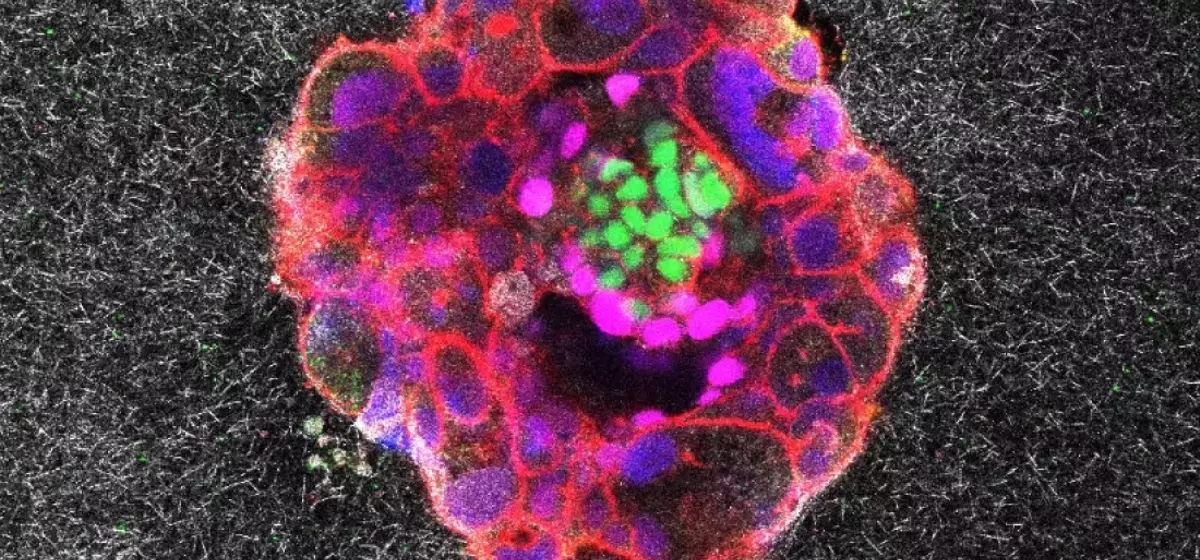 Unveiling Life's First Steps: Real-Time Embryo Implantation Captured