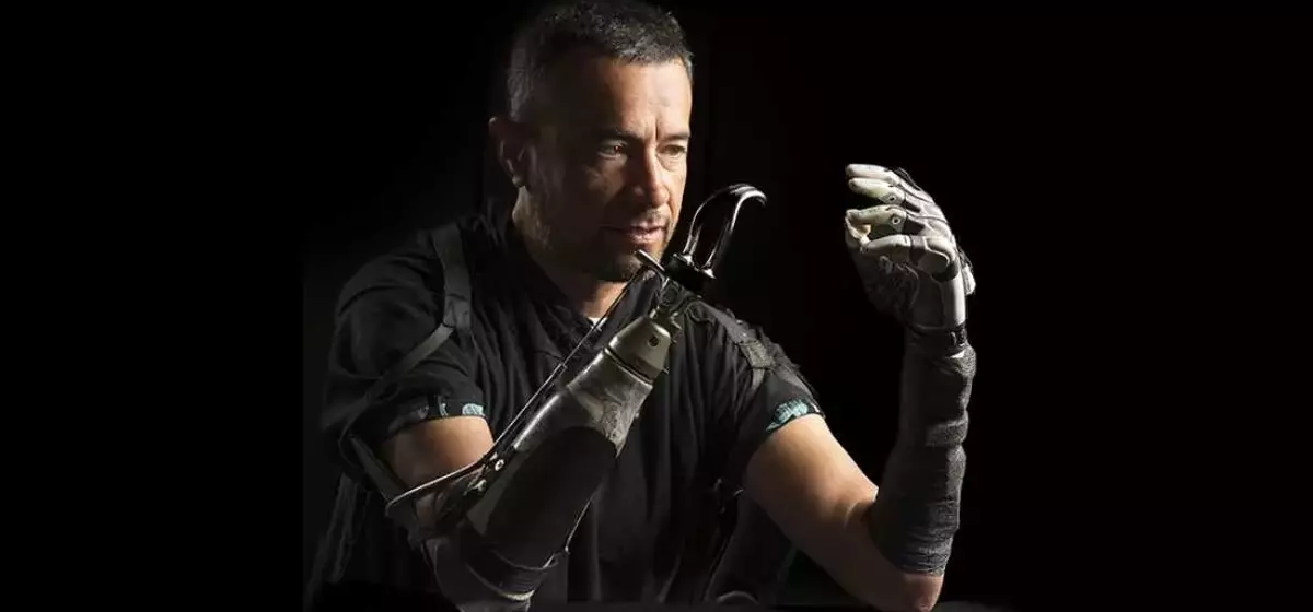 Bridging the Gap: AI Enhances Bionic Hand Functionality for Amputees