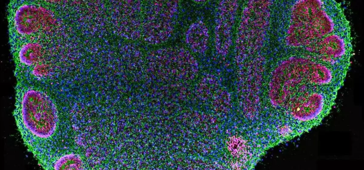 Brain Organoids: Advancements and Ethical Complexities in Neural Research