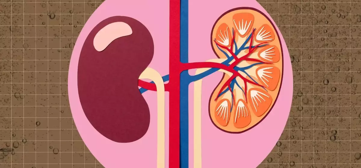 The Impact of Dark Sodas on Kidney Health
