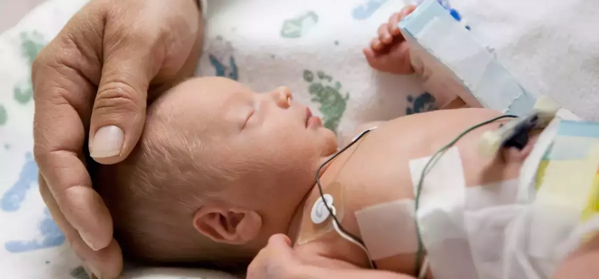 Understanding SSI Benefits for Premature Babies: A Comprehensive Guide