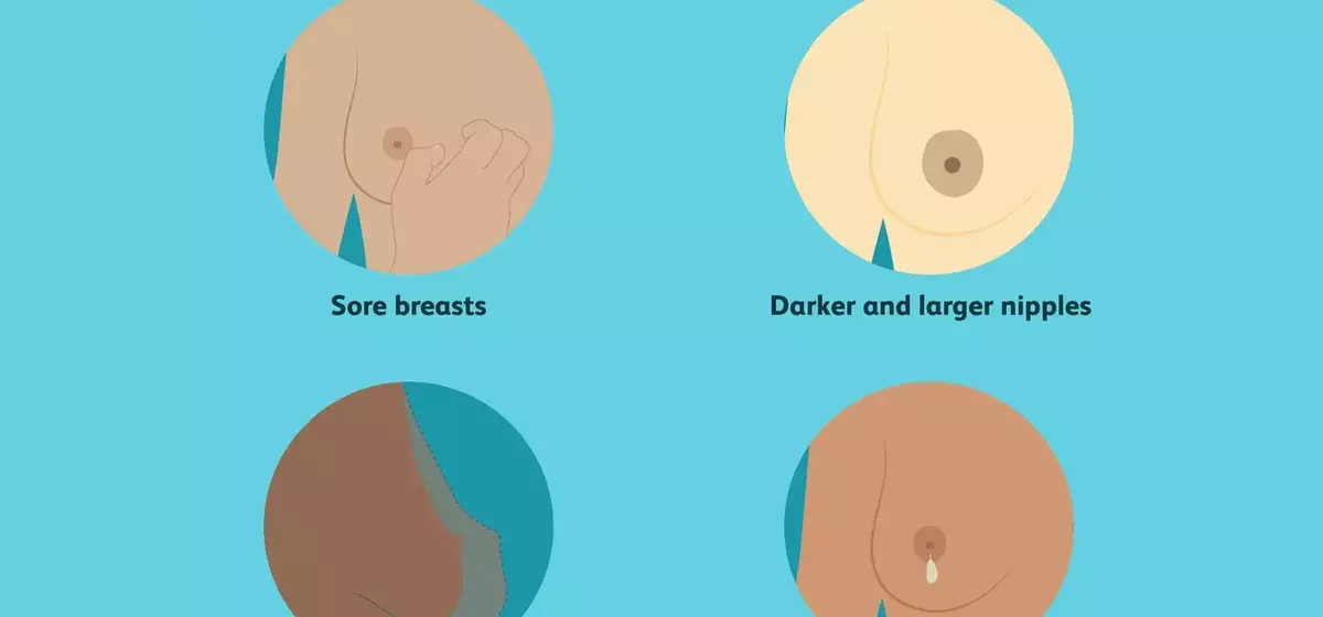 Understanding Breast Transformations During Pregnancy: A Comprehensive Guide