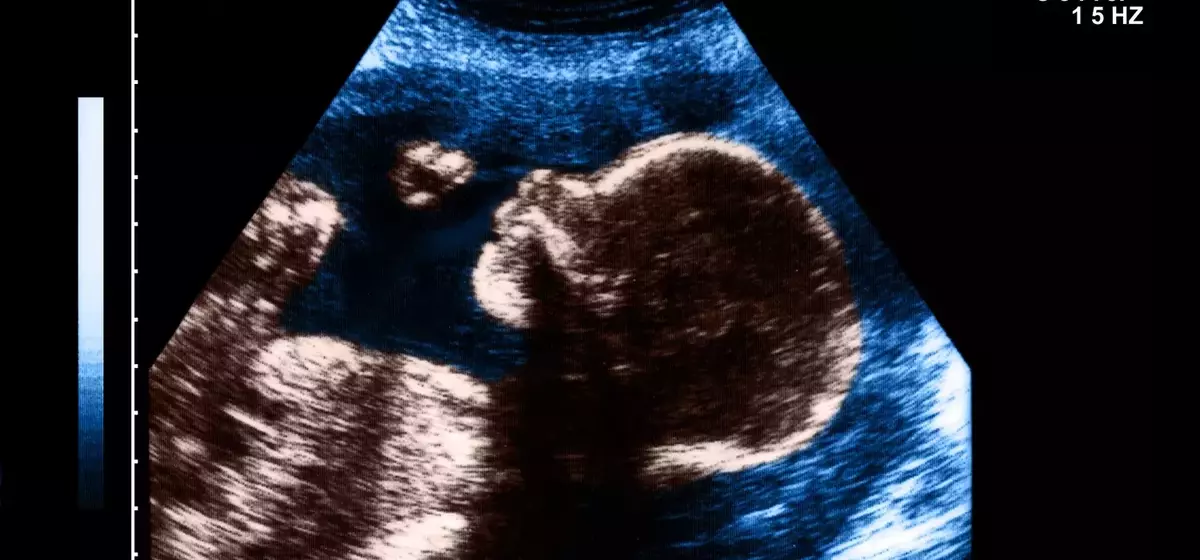 The Art and Impact of Pregnancy Nicknames