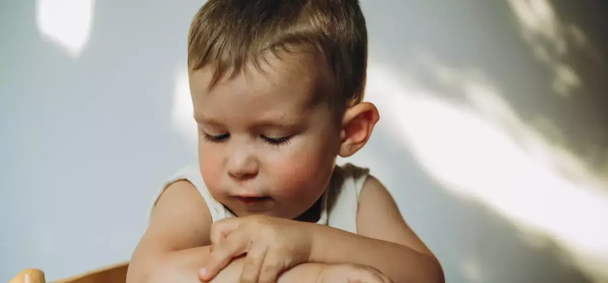 Understanding and Managing Eczema in Children