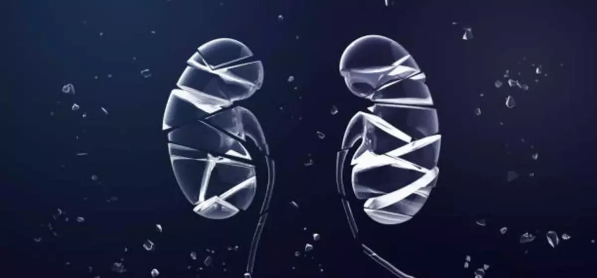 ProKidney's Rilparencel: A High-Stakes Bet on an Unproven Therapy