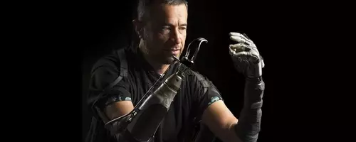 Bridging the Gap: AI Enhances Bionic Hand Functionality for Amputees