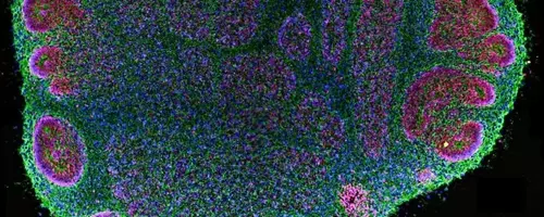 Brain Organoids: Advancements and Ethical Complexities in Neural Research