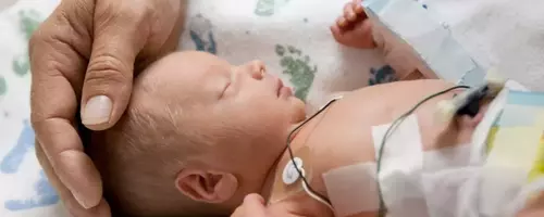 Understanding SSI Benefits for Premature Babies: A Comprehensive Guide