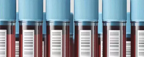 Direct-to-Consumer Blood Testing: Empowerment or Peril?