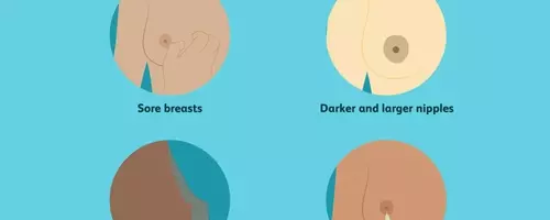 Understanding Breast Transformations During Pregnancy: A Comprehensive Guide