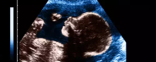 The Art and Impact of Pregnancy Nicknames