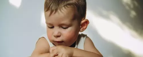 Understanding and Managing Eczema in Children