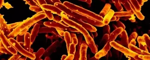 Revolutionizing Tuberculosis Diagnostics: A New Era of Swift and Accurate Detection