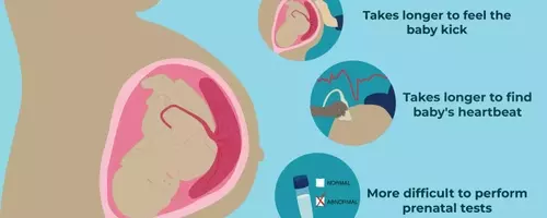 Understanding Anterior Placenta During Pregnancy