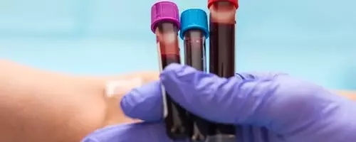 Guardant Health: High Growth, High Valuation, Uncertain Future