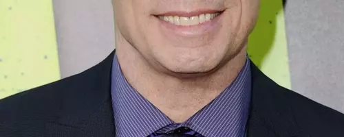 Embracing Baldness: A Journey of Self-Improvement and Confidence